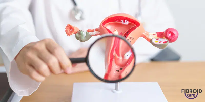 What are fibroids?
